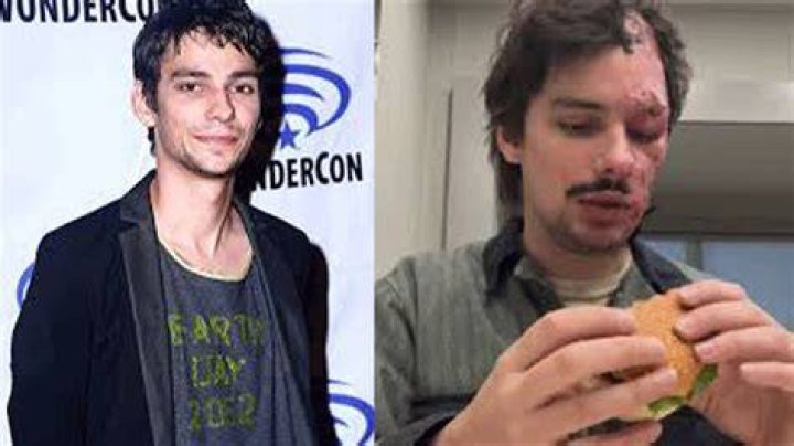 Devon Bostick Accident Update 2023: Where Is He Now? Devon Bostick Accident